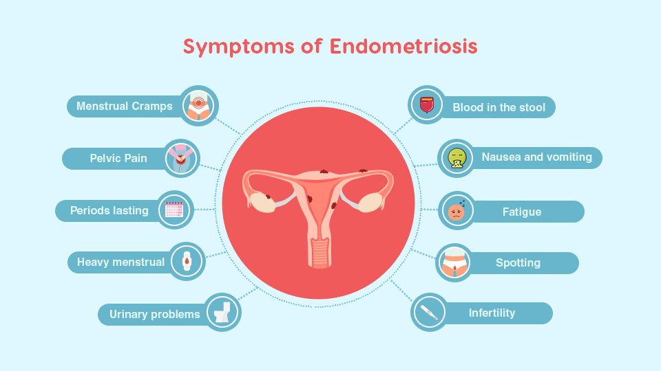 Endometriosis Symptoms Diagnosis And Treatment Matrikaivf