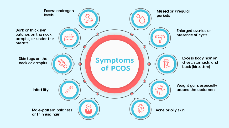 PCOS symptoms and causes